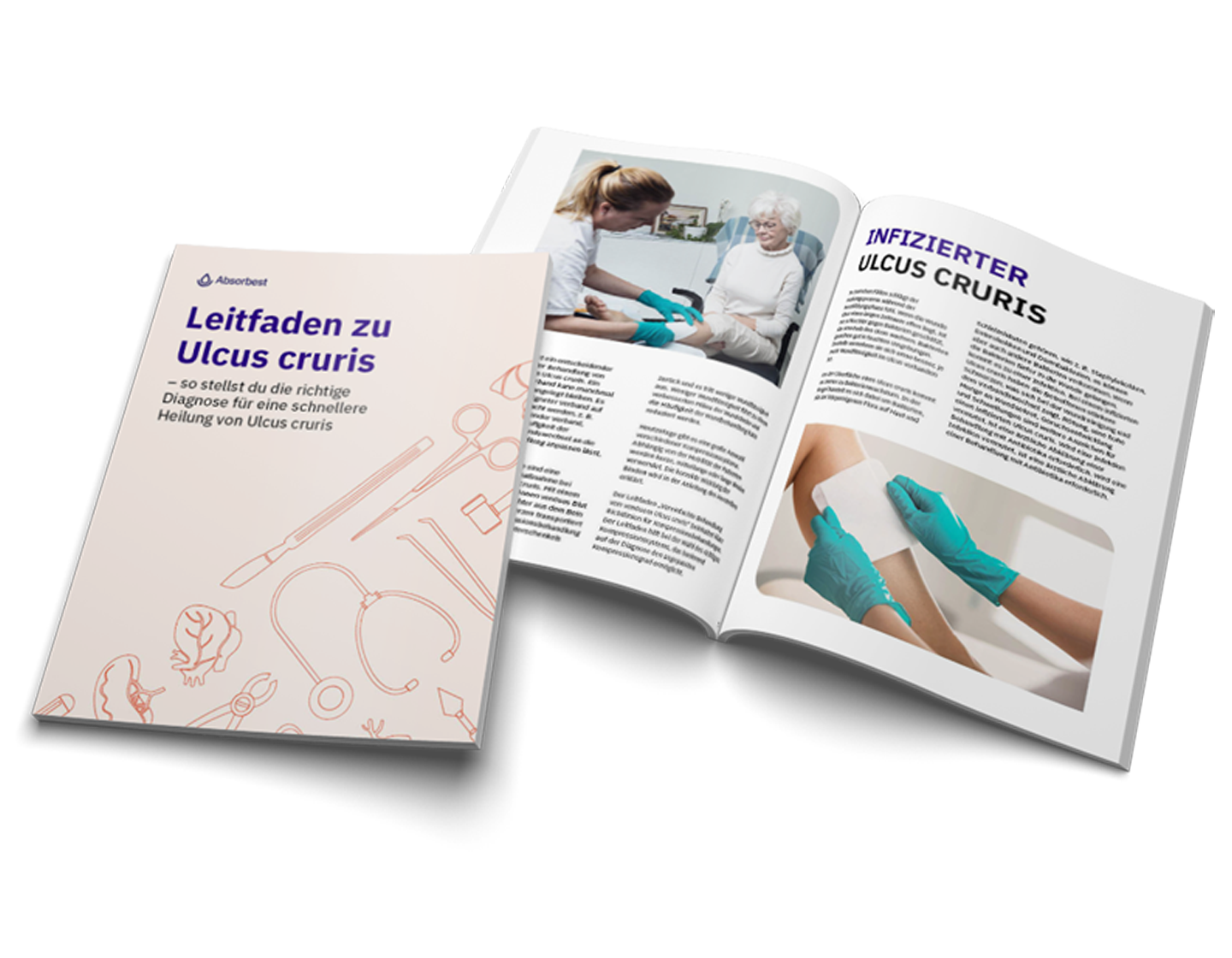 Leitfaden_zu_Ulcus_cruris