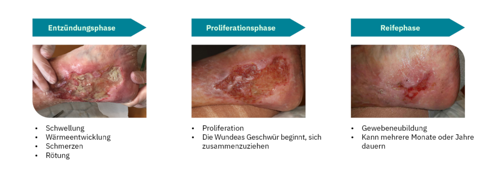 Phasen im Wundheilungsprozess