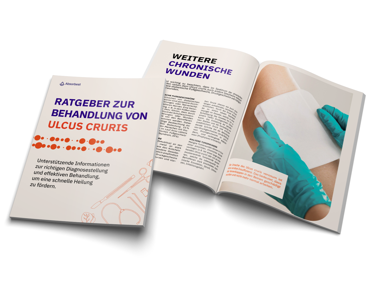 Ratgeber Ulcus Cruris