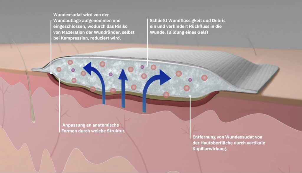 Faktoren bei der Auswahl einer Wundauflage