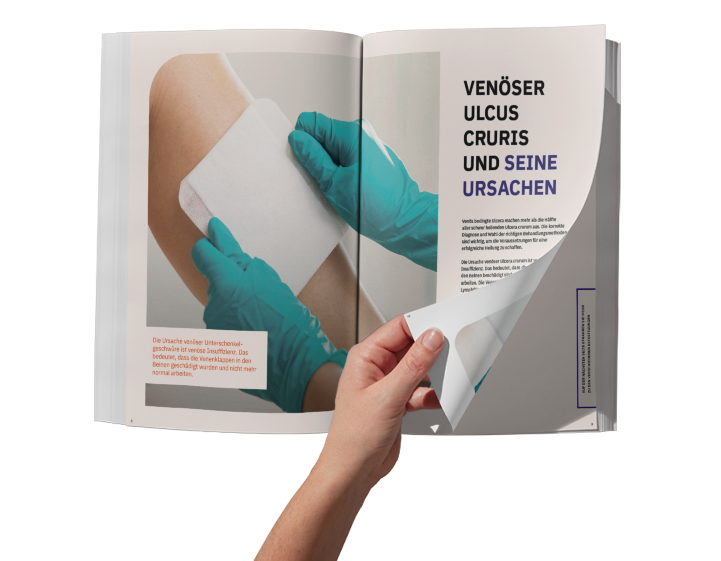 Leitfaden zu Ulcus cruris Umschlag